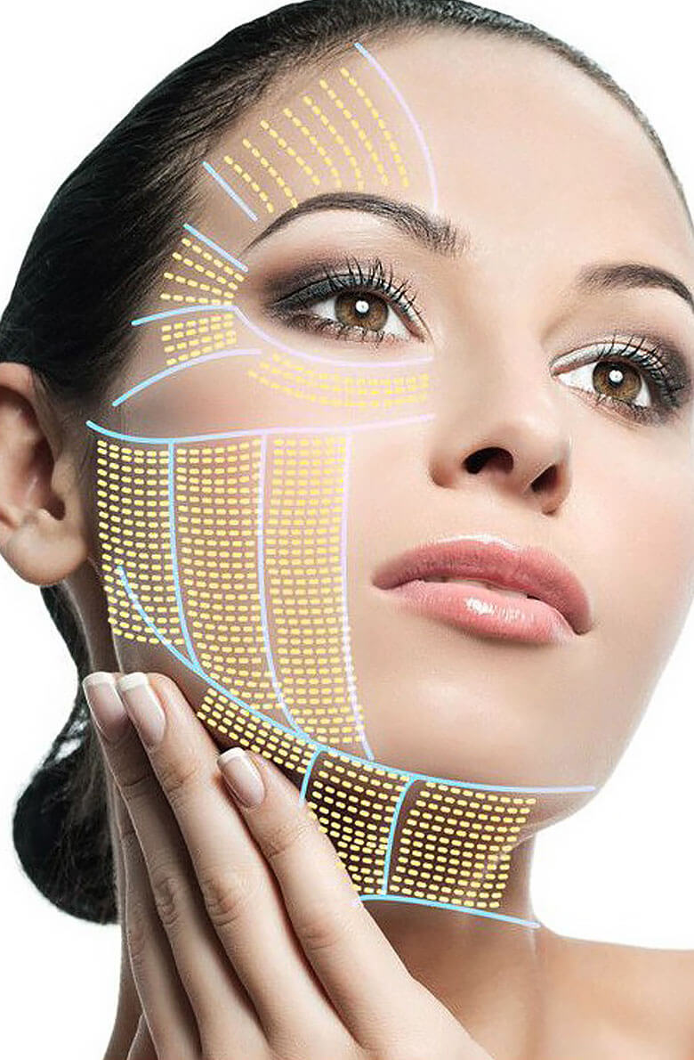 Ulthera System Альтера-терапия