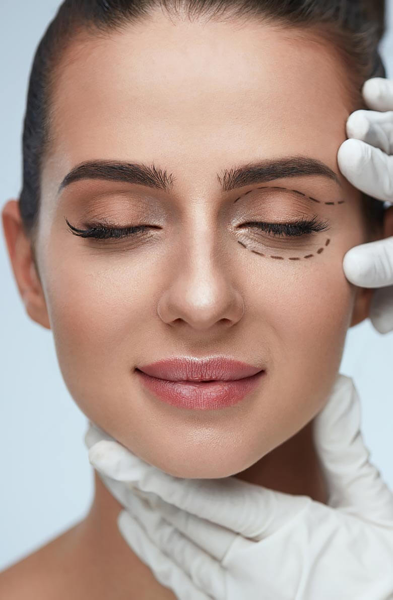 Безоперационная блефаропластика Альтера