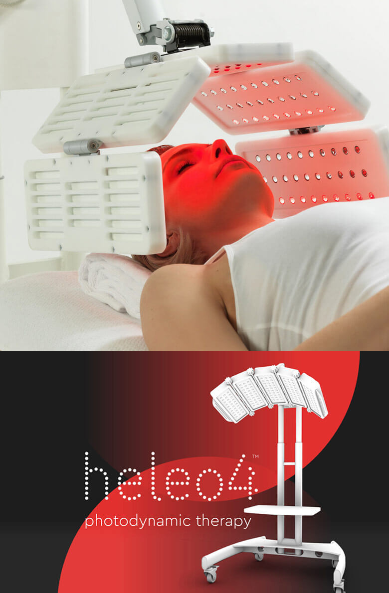Фотодинамическая терапия Heleo-4