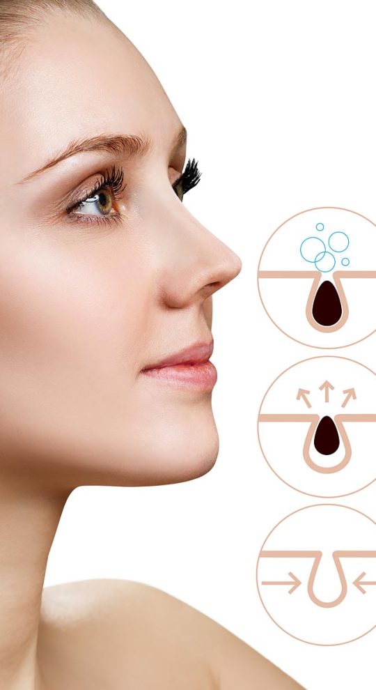 Атравматическая чистка лица и уход Danne