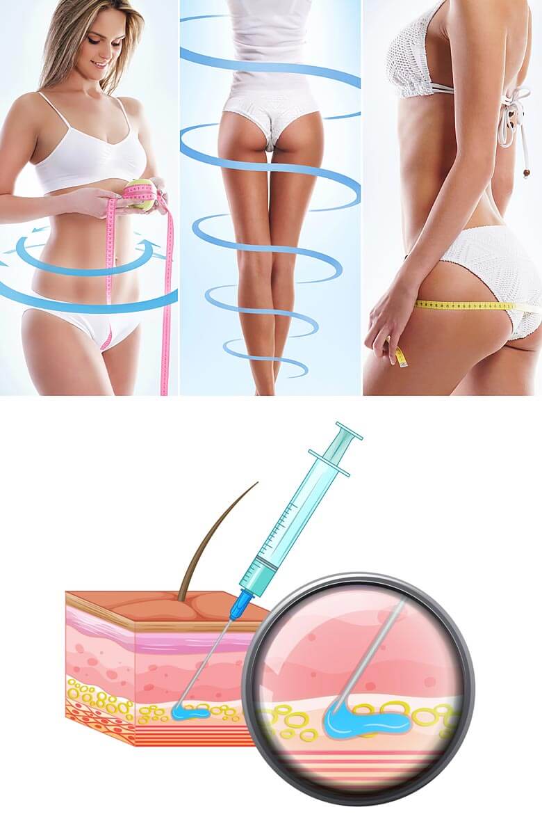 intralipoterapiya-akvaliks-aqualyx-2