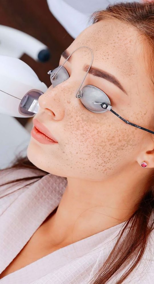 Лечение пигментации М22