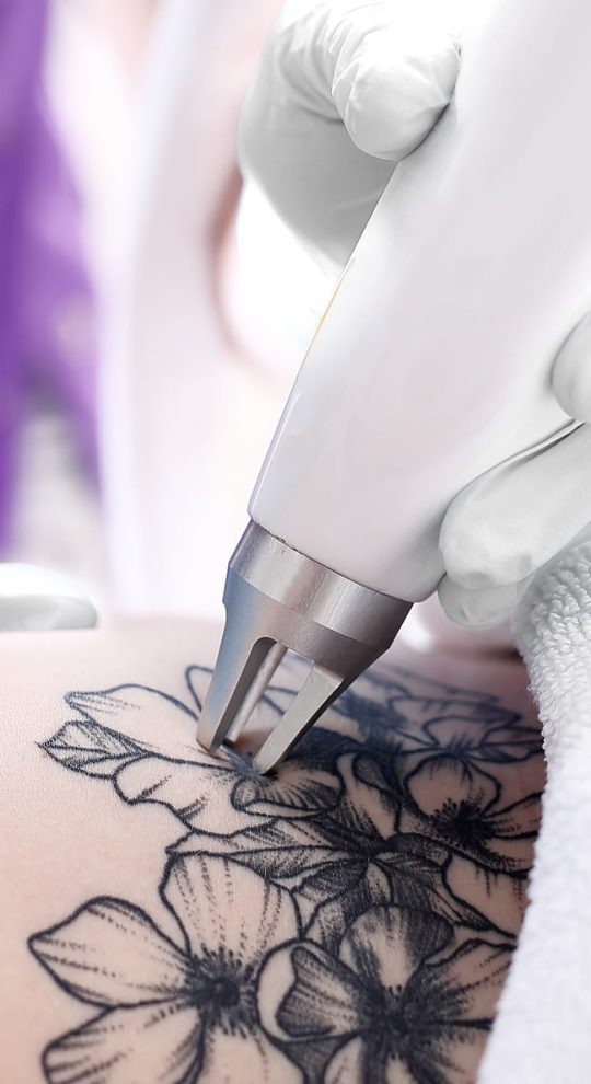 Удаление татуировок PicoSure