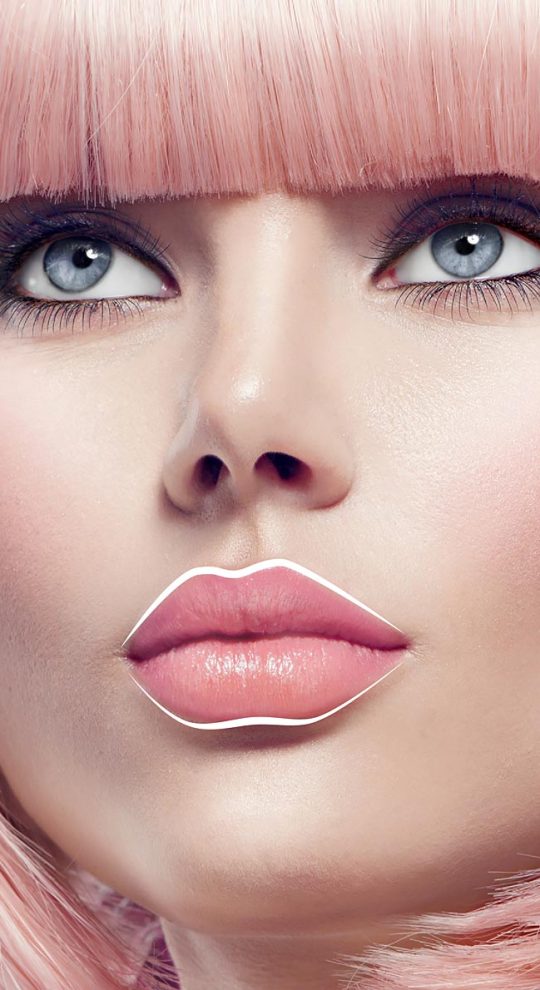 Хейлопластика