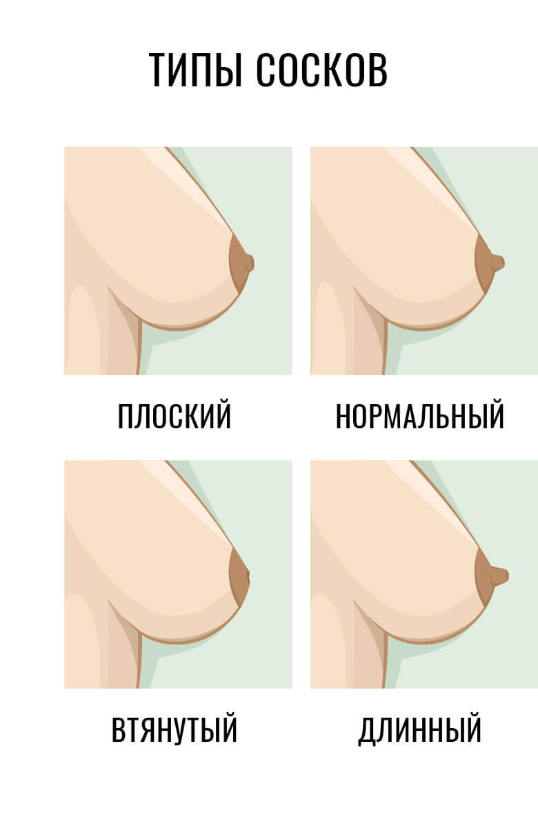 korrektsiya-soskov-2