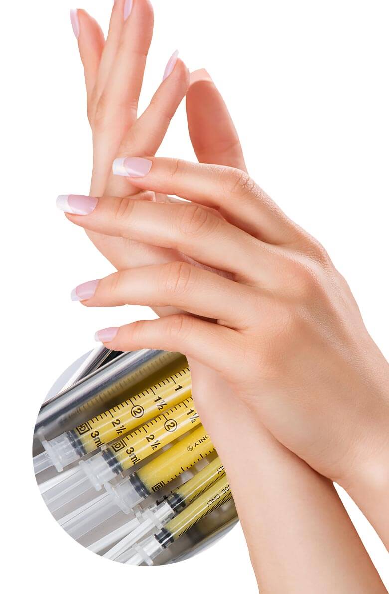 Липофилинг кистей рук