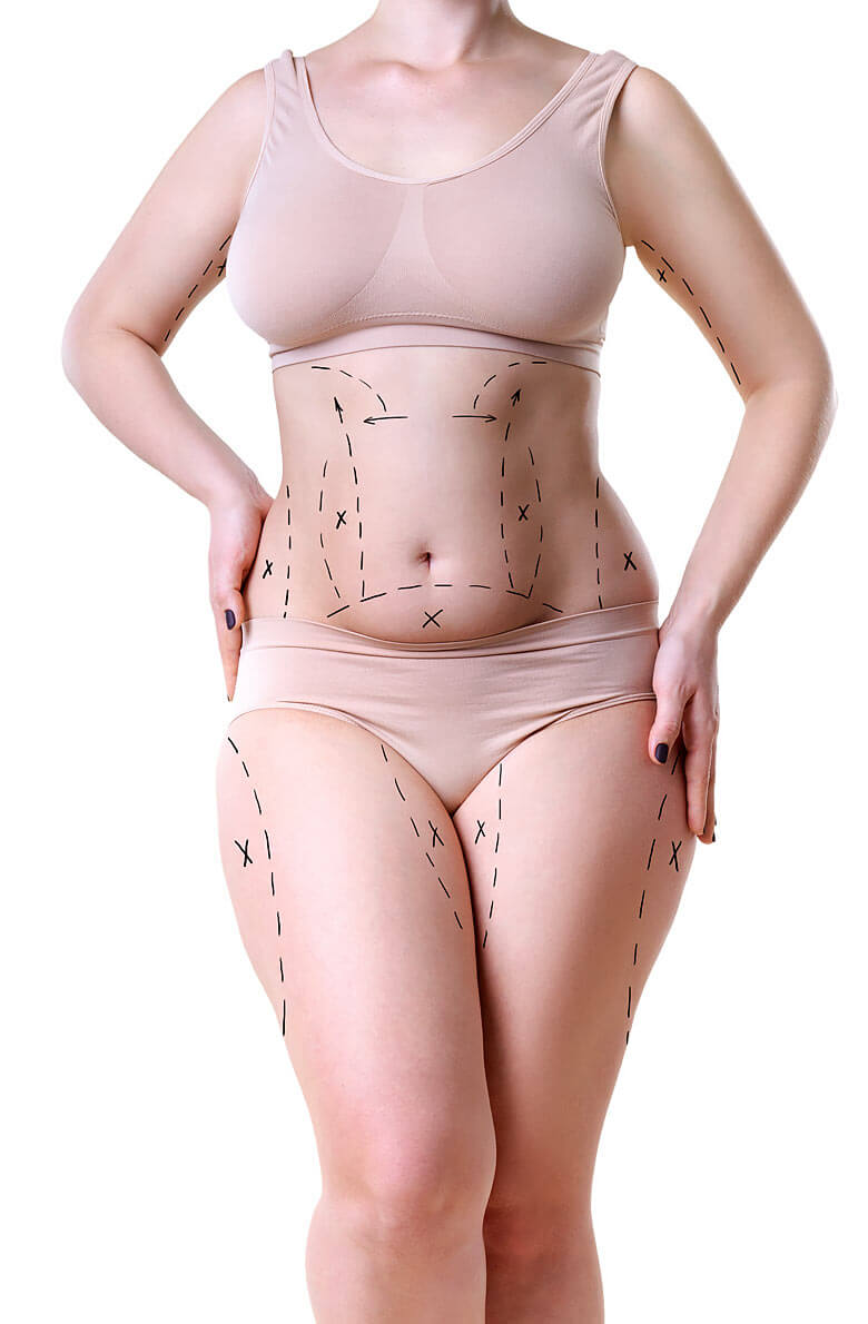 Липомоделирование тела