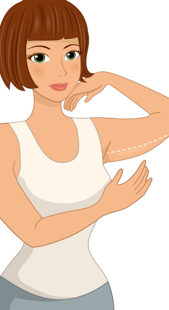 Липосакция рук