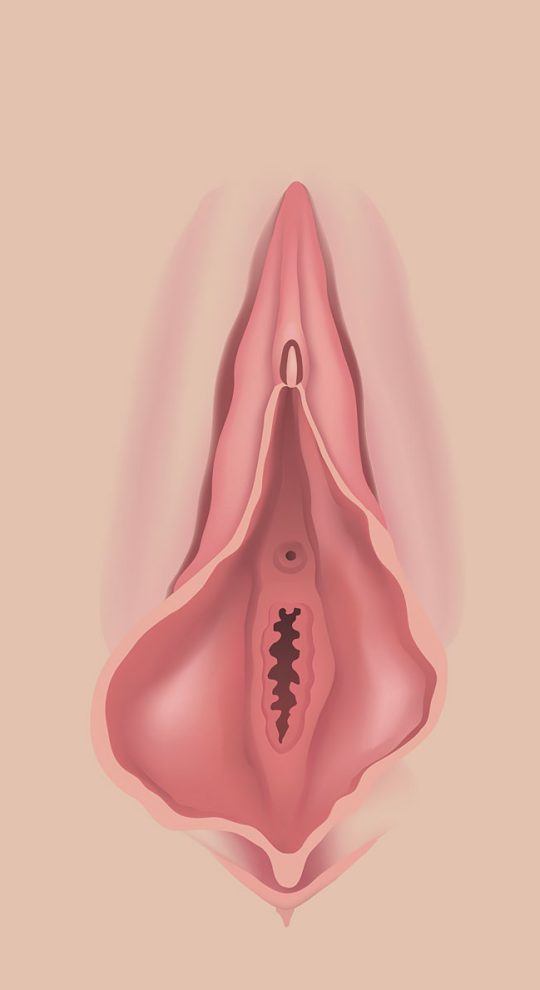 Пластика половых губ