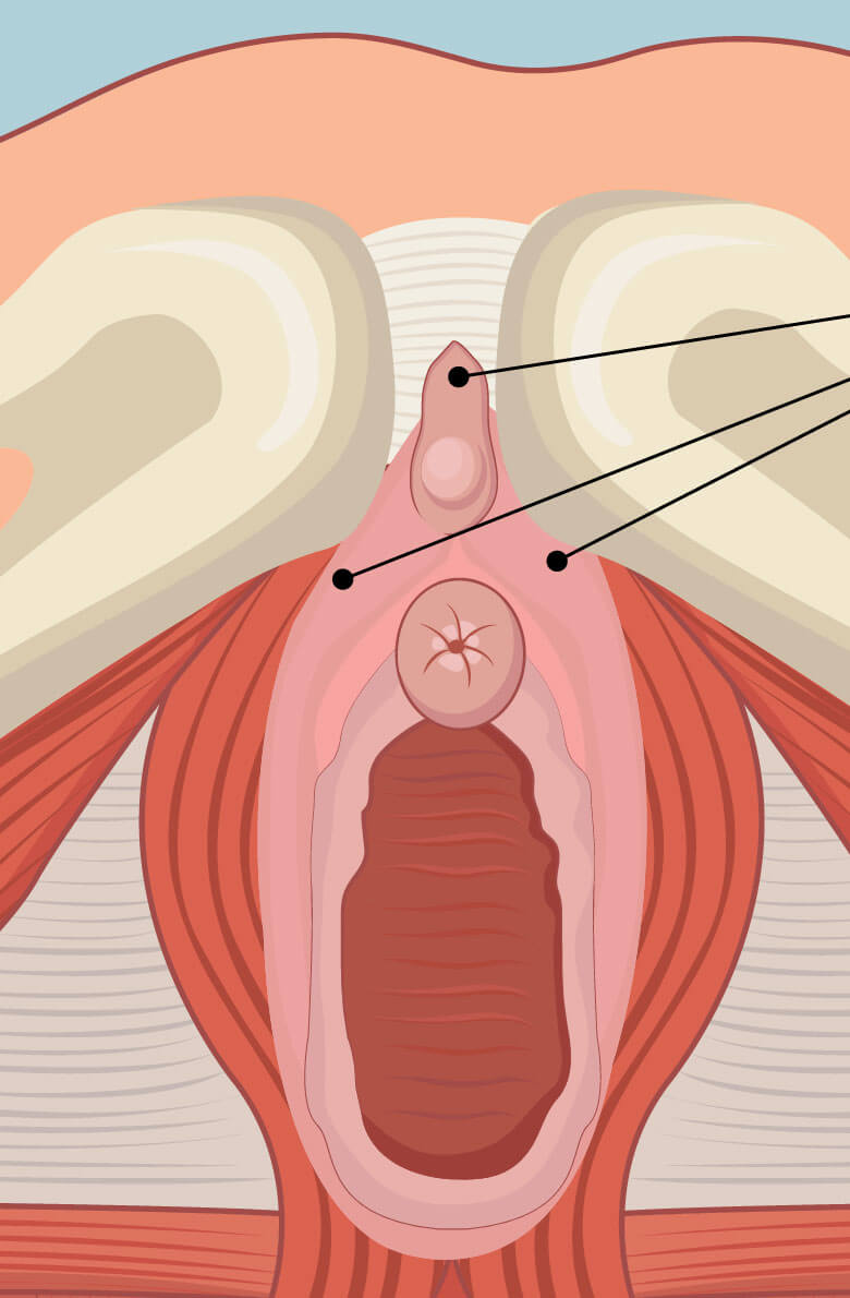 udalenie-kapyushona-klitora-2
