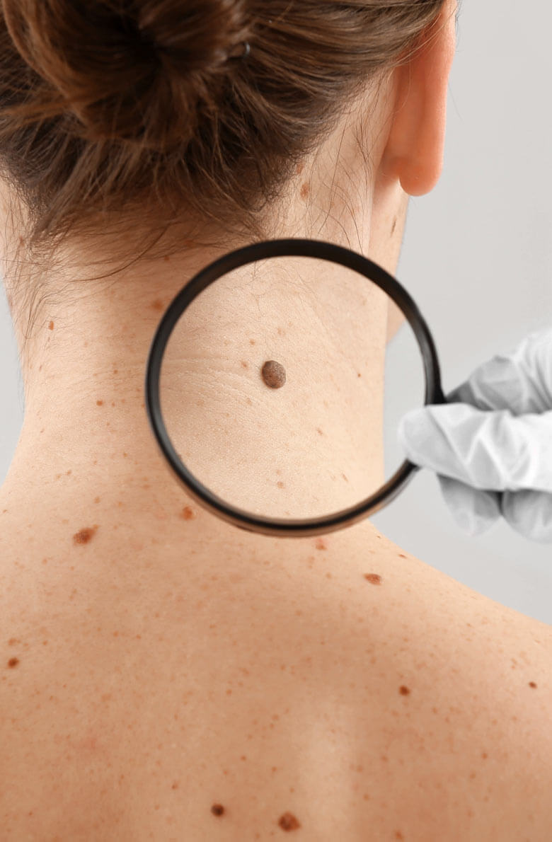 udalenie-novoobrazovaniy-22