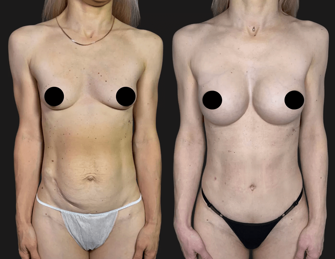 Послеродовое восстановление 01