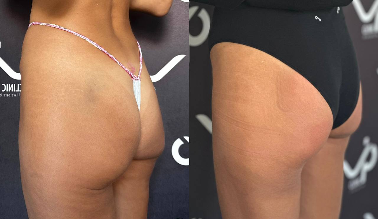 Аппарат EVOLVE 01