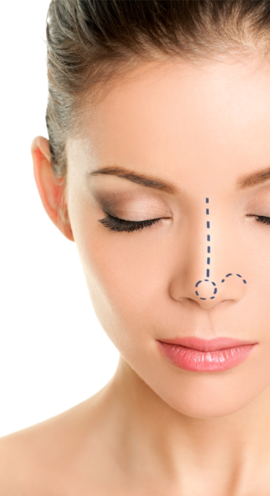 Ринопластика кончика носа