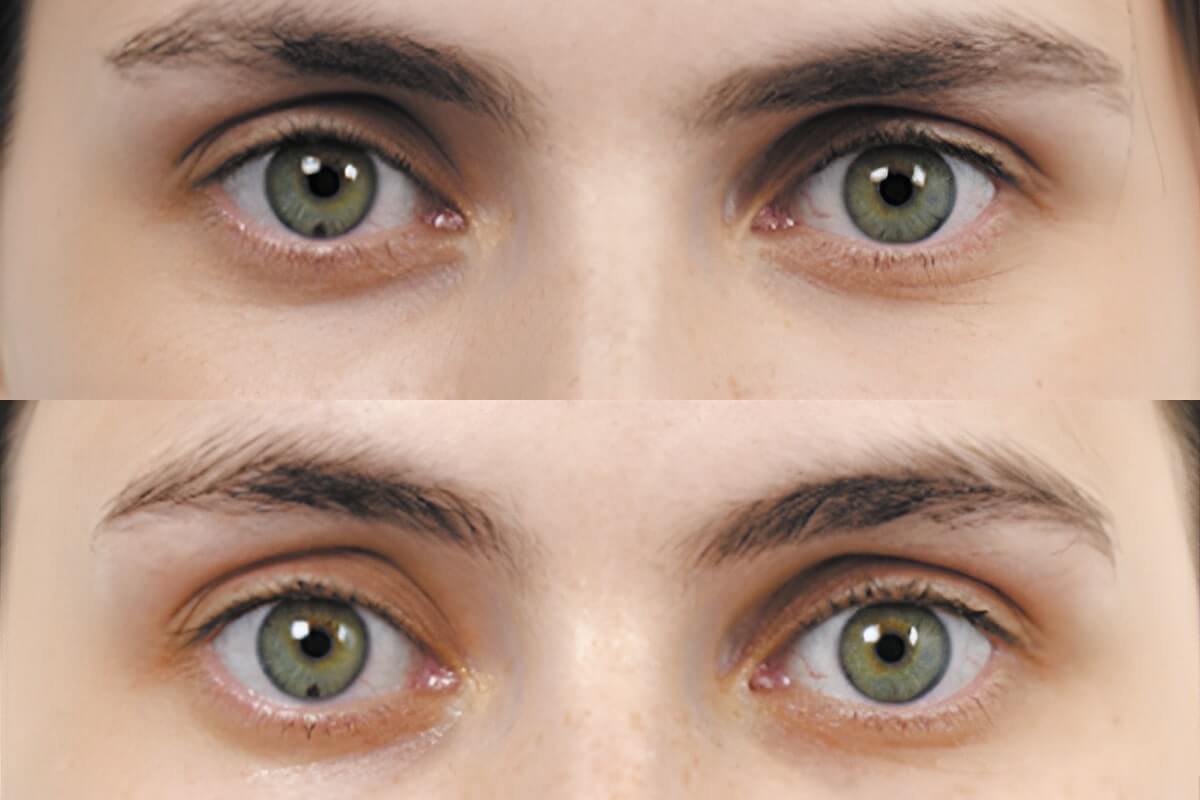 Ультраформер MPT 01