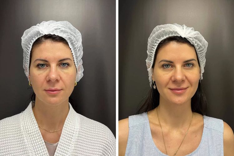 Летние уходовые процедуры для лица у косметолога