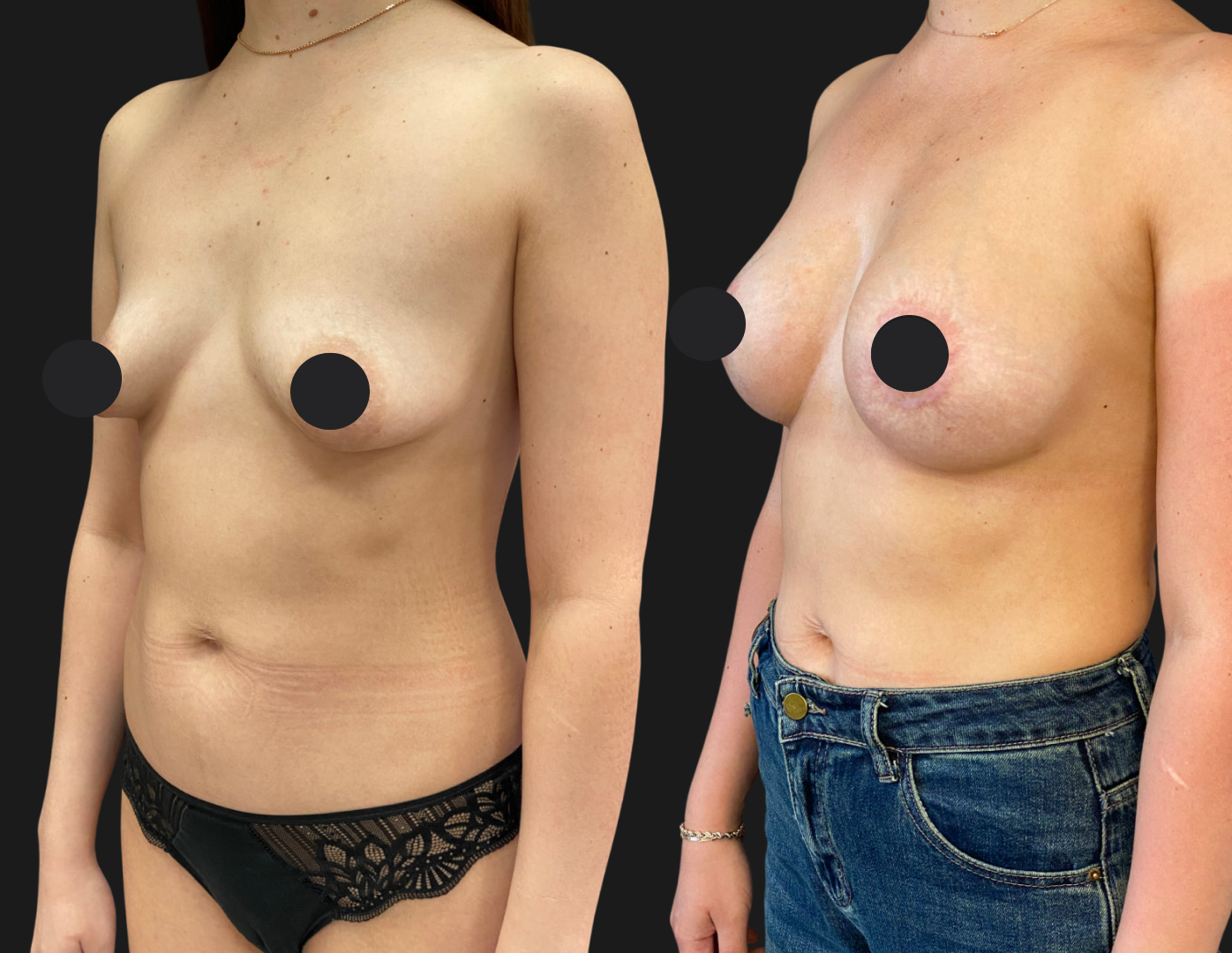 Грудь для мам 01