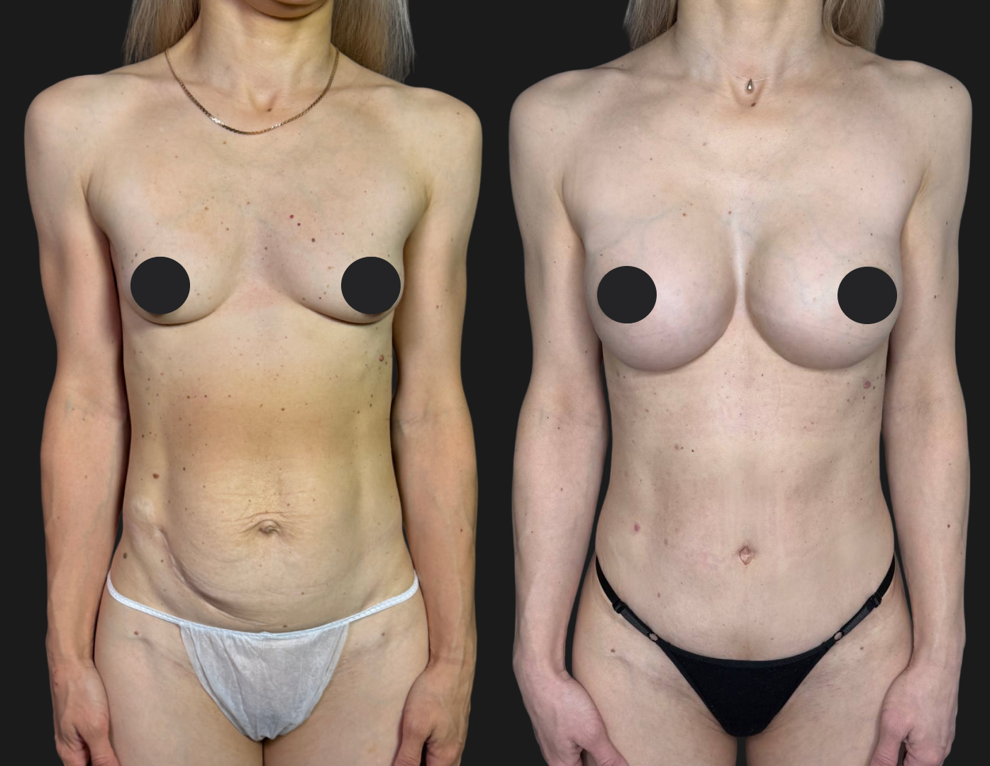 Грудь для мам 01