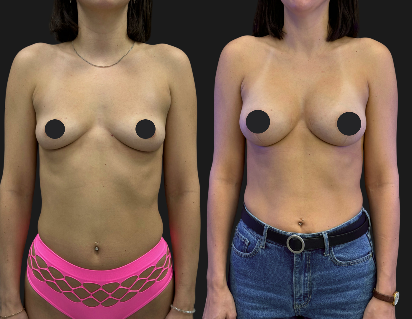 Грудь для мам 01