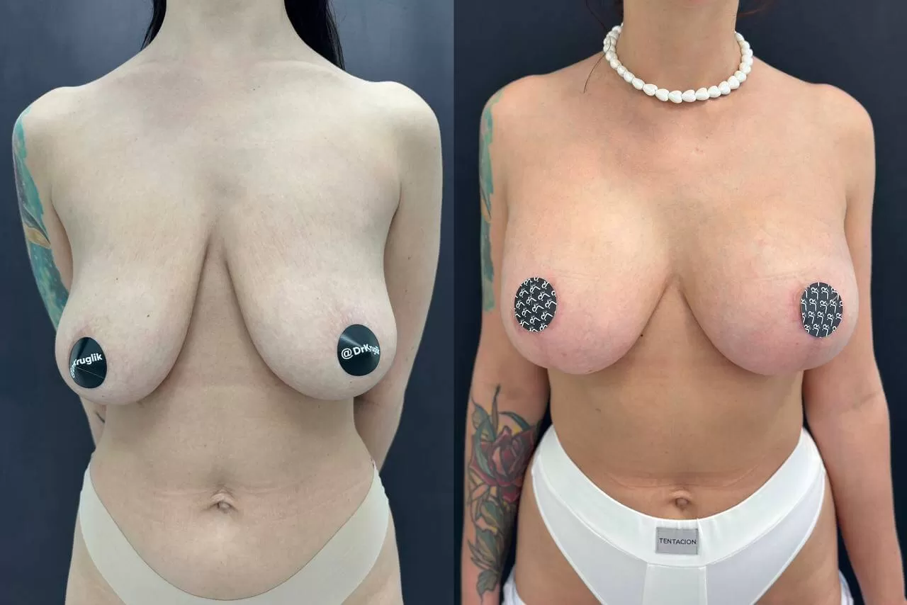 Грудь для мам 01