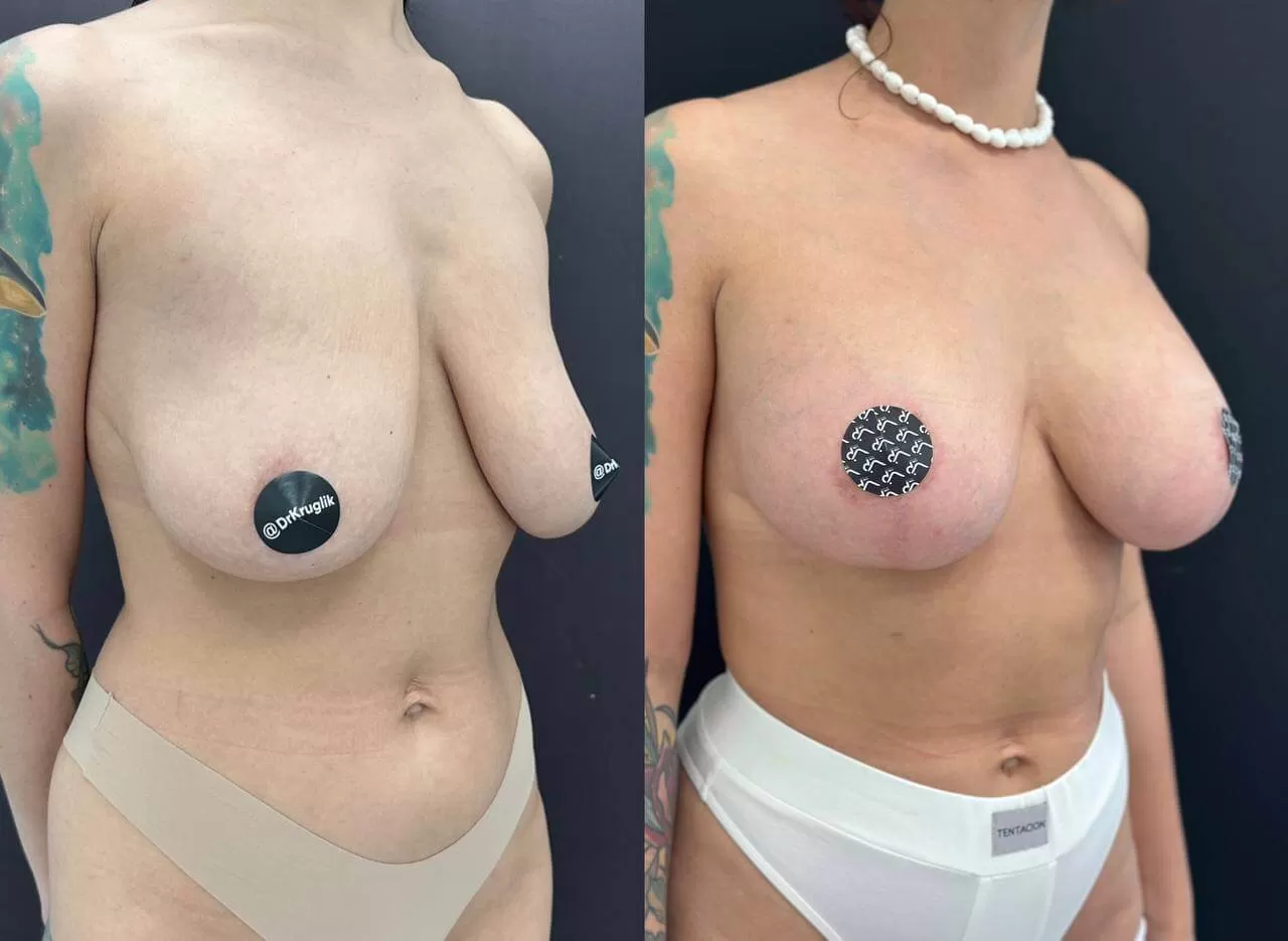 Грудь для мам 01