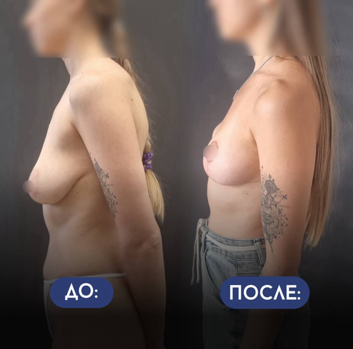 Грудь для мам 01