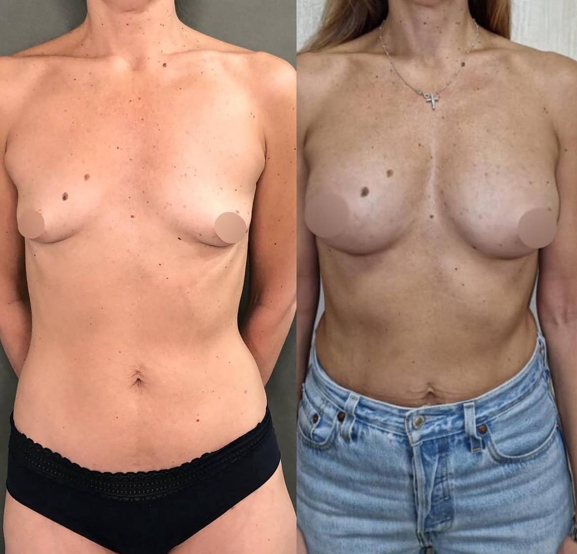 Грудь для мам 01