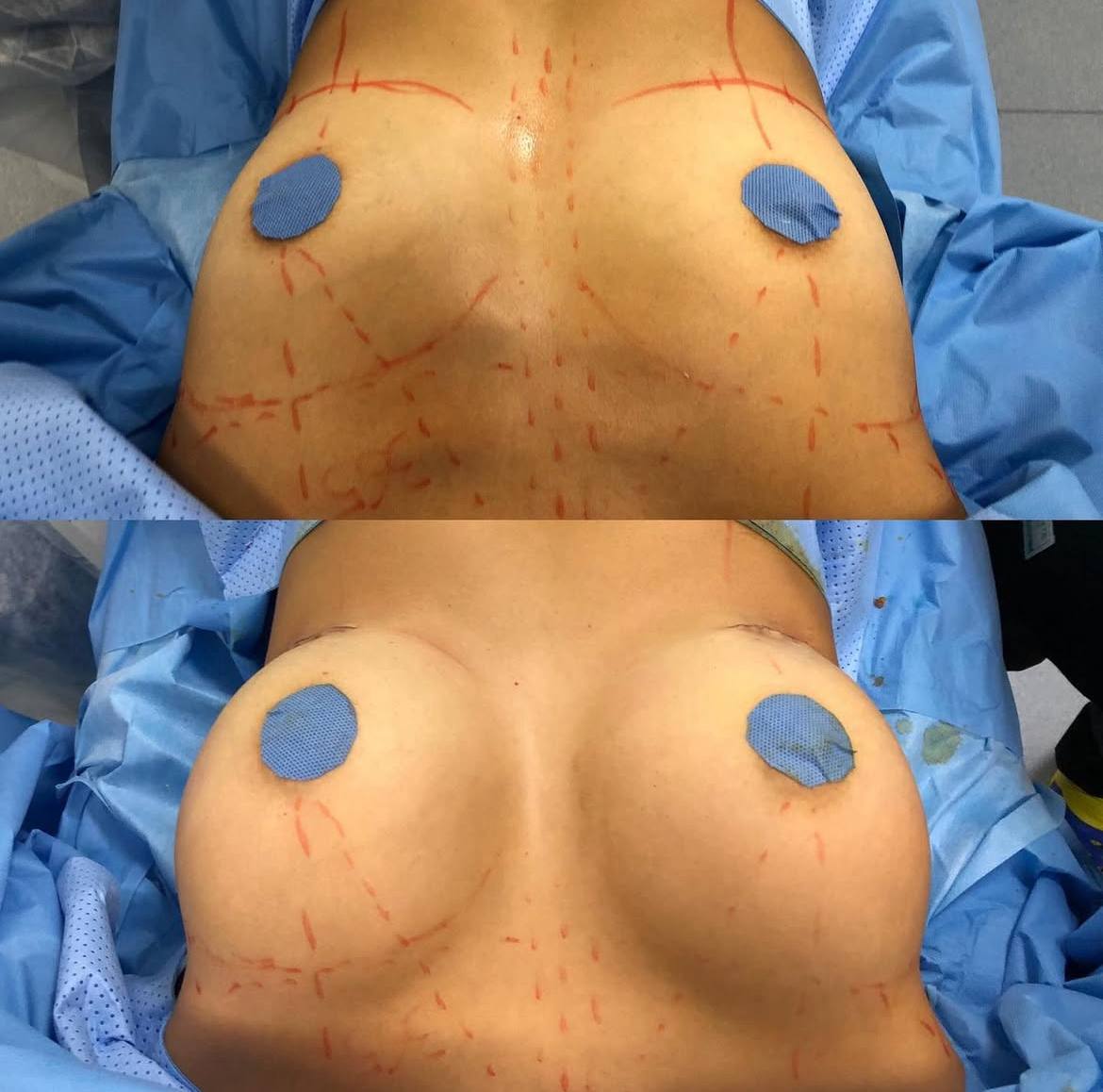 Грудь для мам 01