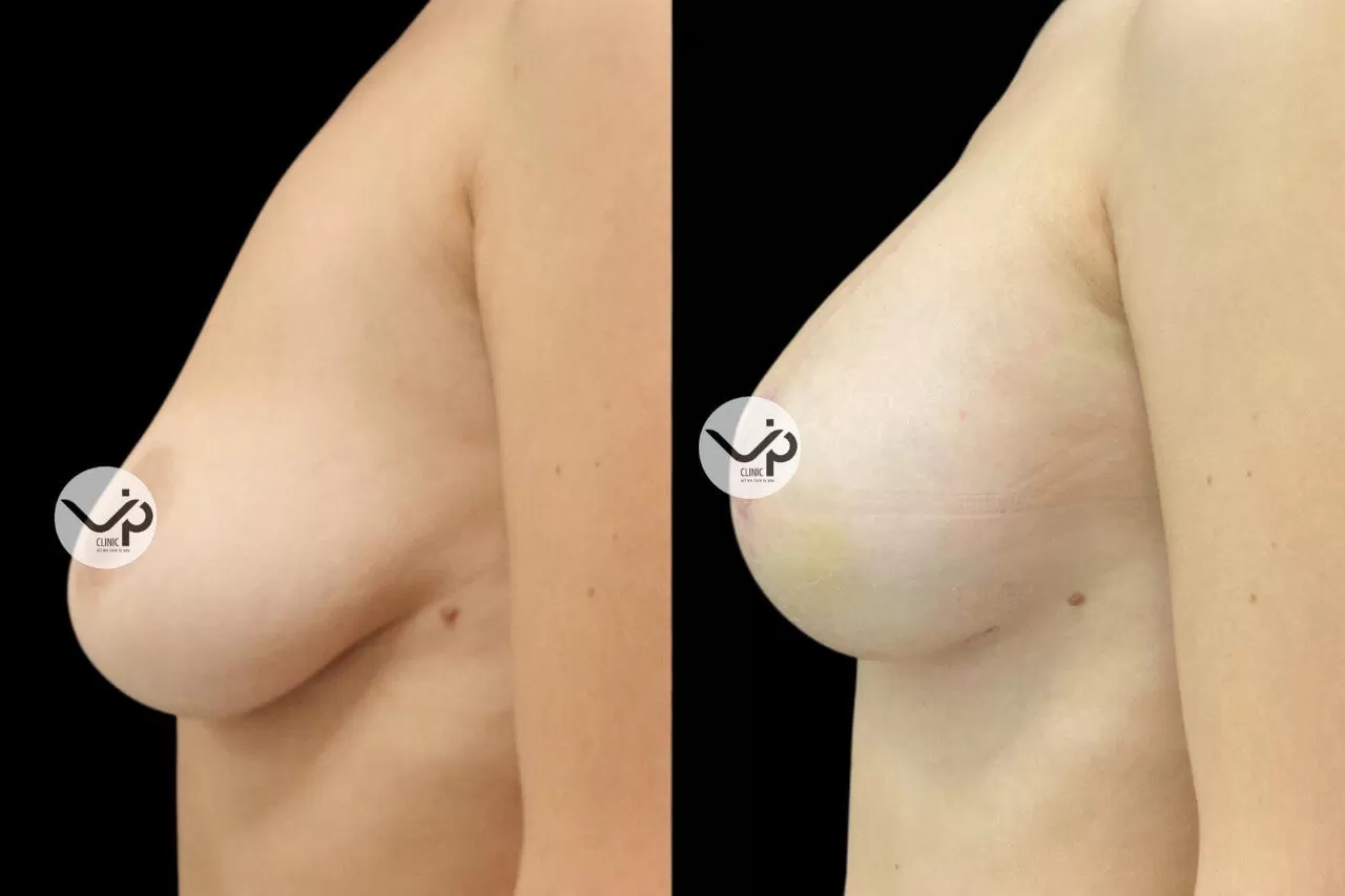 Грудь для мам 01