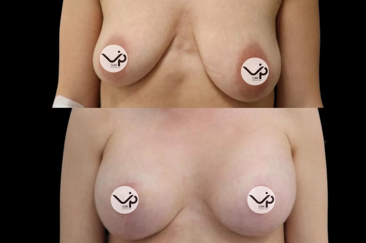 Грудь для мам 01