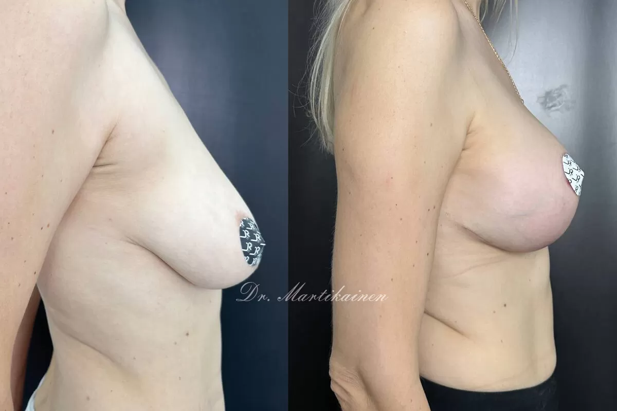 Грудь для мам 01