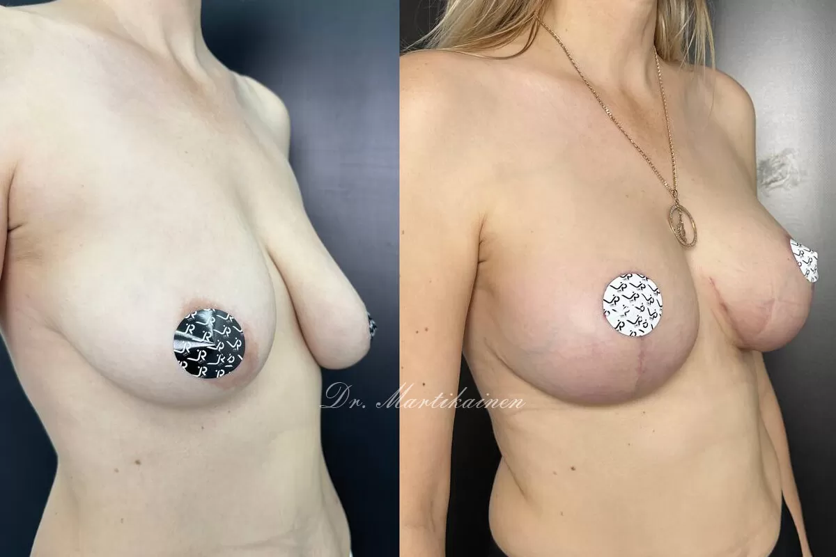 Грудь для мам 01