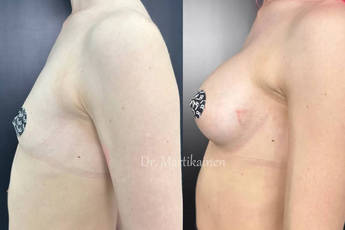 Грудь для мам 01