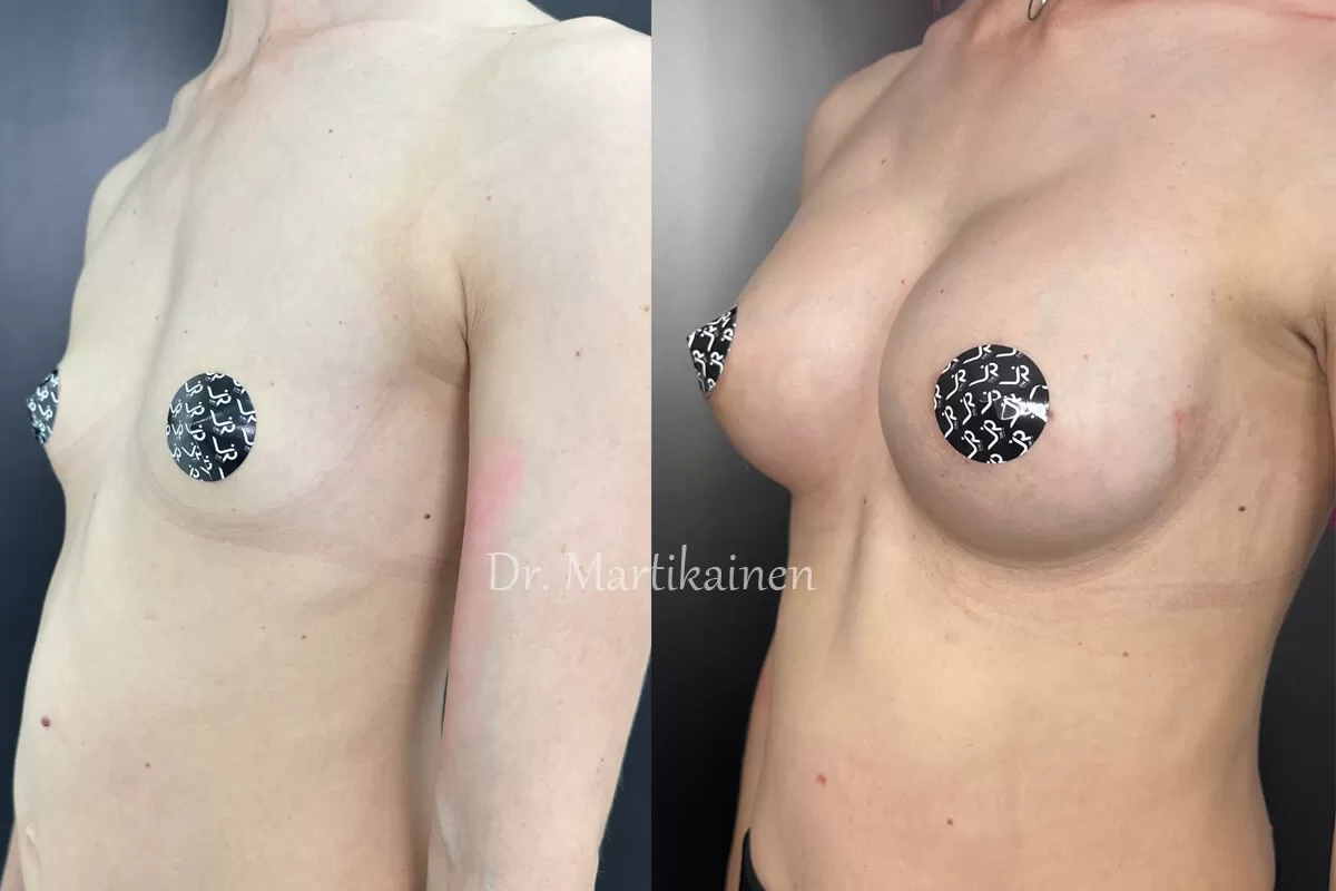 Грудь для мам 01