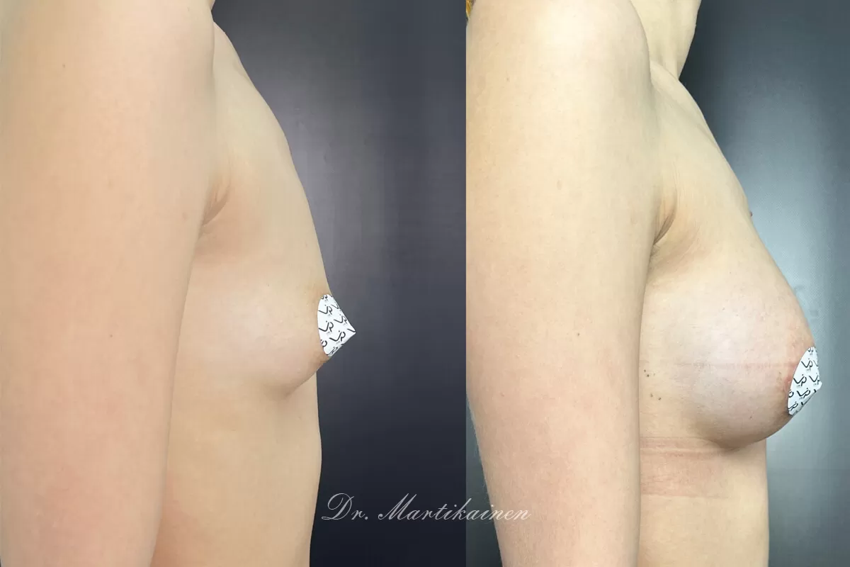 Грудь для мам 01